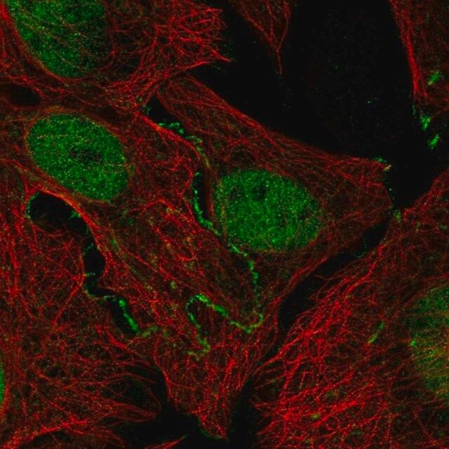 Anti-JAK2 antibody produced in rabbit