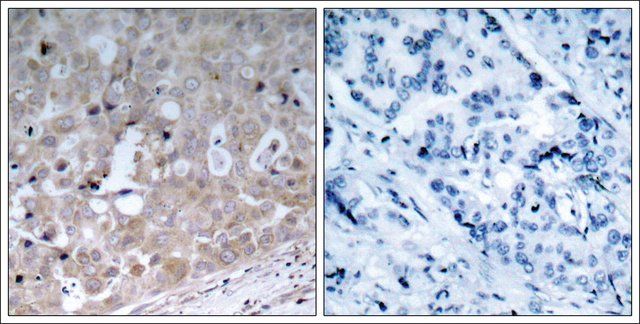 Anti-KDR (Ab-1175) antibody produced in rabbit