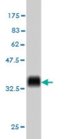 ANTI-KIT antibody produced in mouse