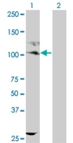 ANTI-KIT antibody produced in mouse