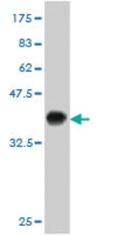 ANTI-KIT antibody produced in mouse