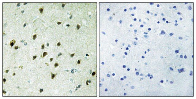 Anti-MAD4 antibody produced in rabbit