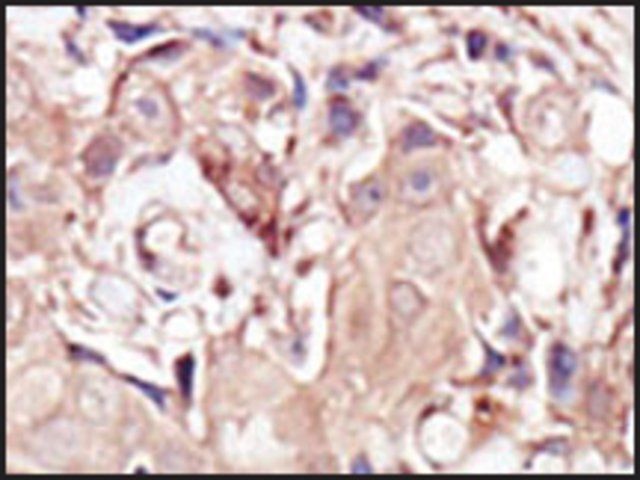 Anti-MCK10 (C-term) antibody produced in rabbit