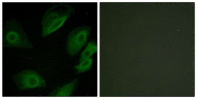 Anti-LCK antibody produced in rabbit