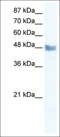 Anti-MAP3K8 antibody produced in rabbit