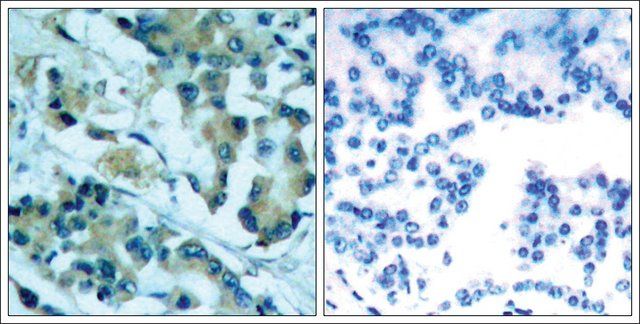 Anti-MAP2K1/MAP2K2 (Ab-217/221) antibody produced in rabbit