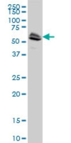 ANTI-LCK antibody produced in mouse