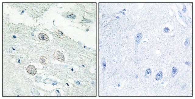 Anti-JAK1 antibody produced in rabbit