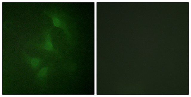 Anti-JNK1 antibody produced in rabbit