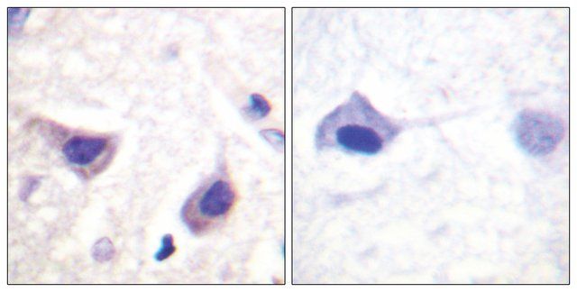 Anti-JAK3 antibody produced in rabbit