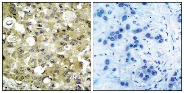 Anti-KDR (Ab-951) antibody produced in rabbit