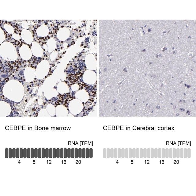 Anti-CEBPE antibody produced in rabbit