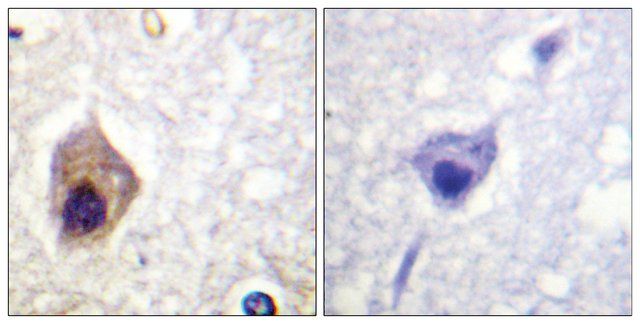 Anti-CASP1, C-Terminal antibody produced in rabbit