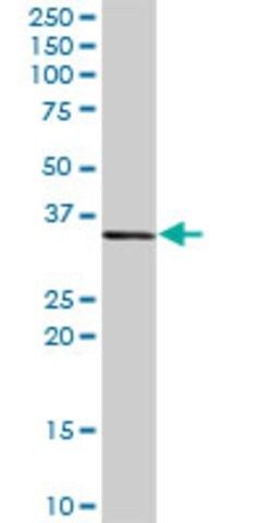 Anti-CEBPE antibody produced in rabbit