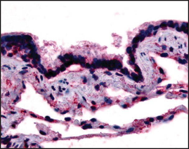 Anti-CAV1 antibody produced in rabbit