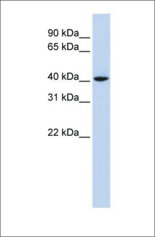 Anti-CCND1 (ab1) antibody produced in rabbit