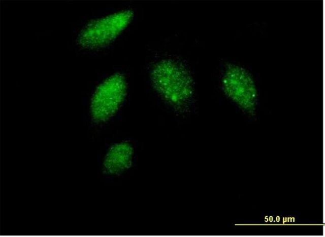 Anti-CCNG1 antibody produced in mouse