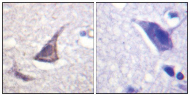 Anti-C/EBP- antibody produced in rabbit