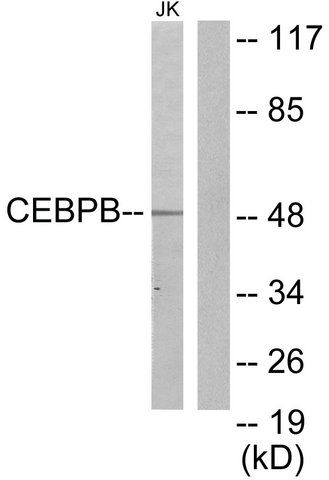 Anti-CEBPB antibody produced in rabbit