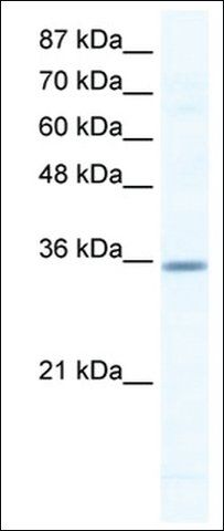 Anti-CCNG2 antibody produced in rabbit