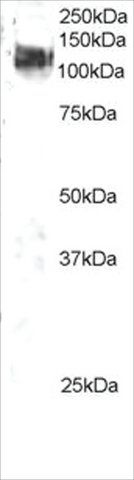 Anti-CBL antibody produced in goat