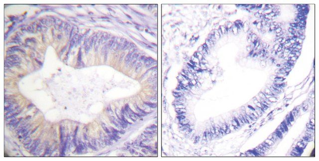 Anti-CBL antibody produced in rabbit