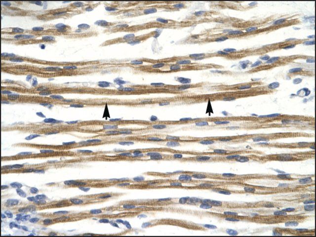 Anti-CCND3 antibody produced in rabbit