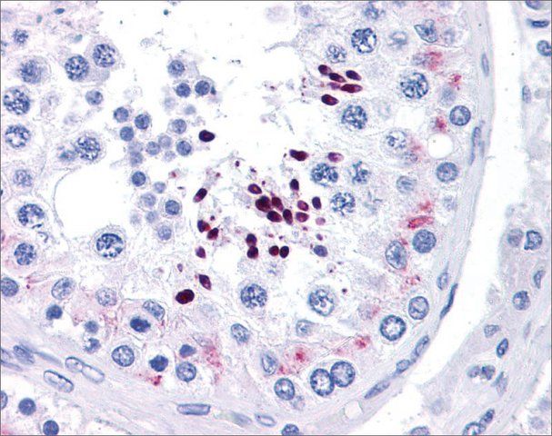 Anti-CCND1 (ab3) antibody produced in rabbit