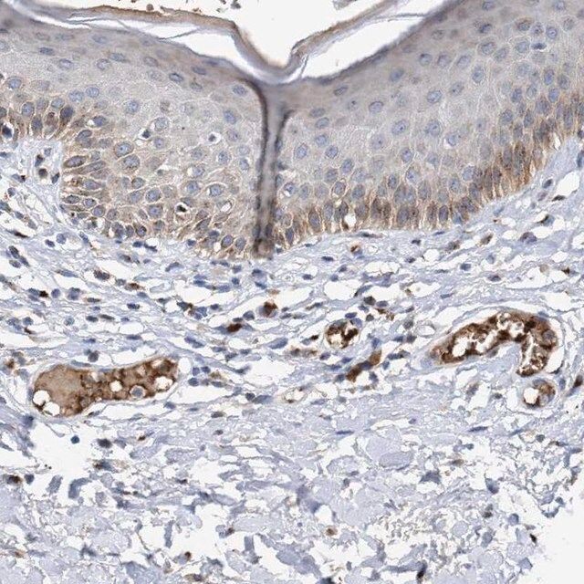 Anti-CCL2 antibody produced in rabbit