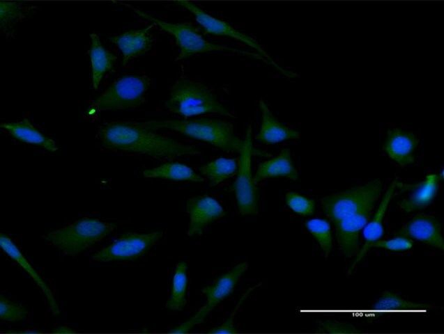 Anti-CCND2 antibody produced in rabbit