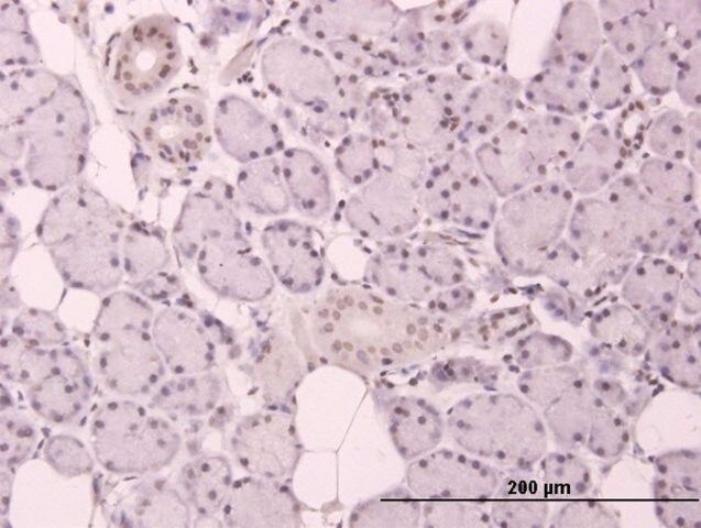 Anti-CCND3 antibody produced in mouse