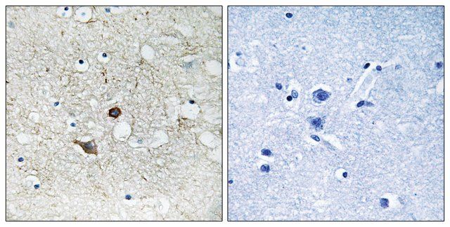 Anti-CASP2 antibody produced in rabbit