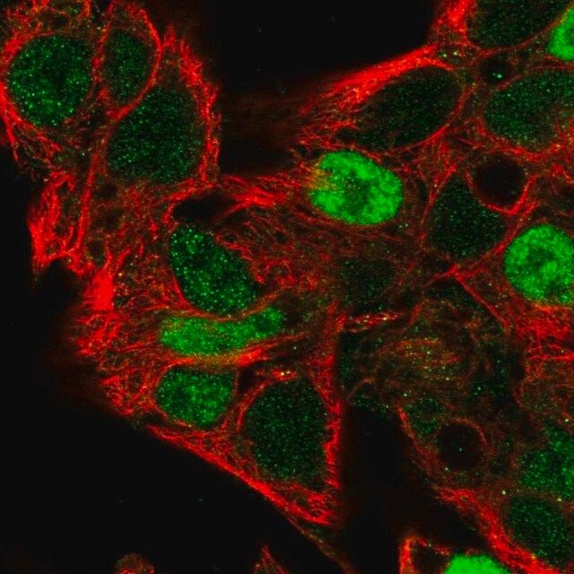 Anti-CCND2 antibody produced in rabbit