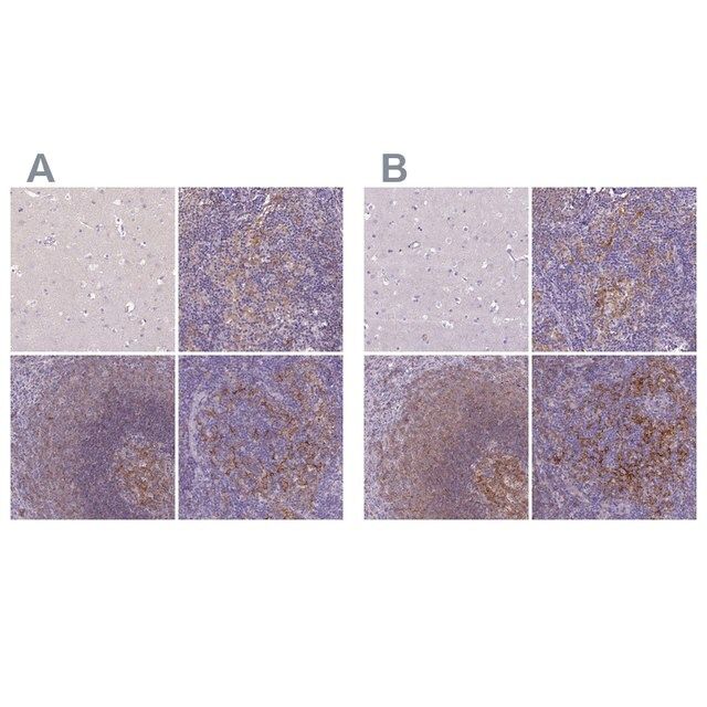 Anti-CD40 antibody produced in rabbit