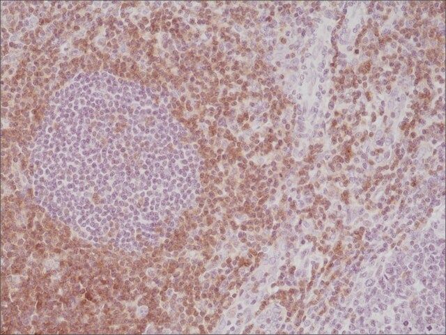 Anti-CD5 antibody, Rabbit monoclonal