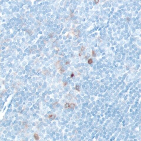 Anti-CD25 antibody, Rabbit monoclonal