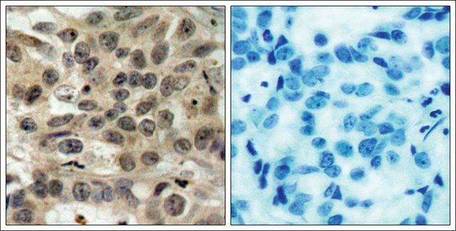 Anti-CDC25C (Ab-216) antibody produced in rabbit