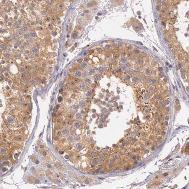 Anti-CDK16 antibody produced in rabbit