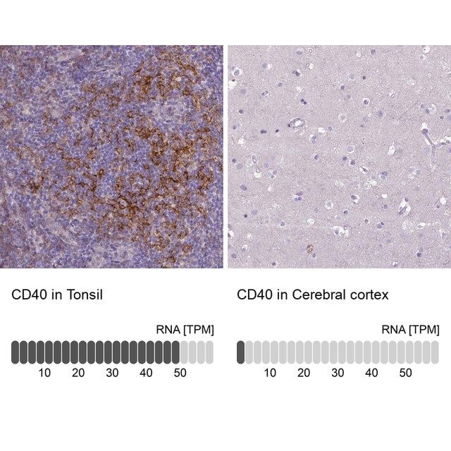 Anti-CD40 antibody produced in rabbit