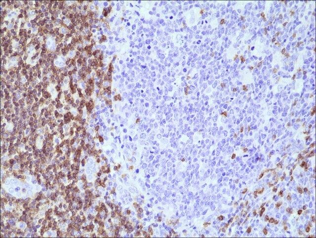 Anti-CD5 antibody, Rabbit monoclonal