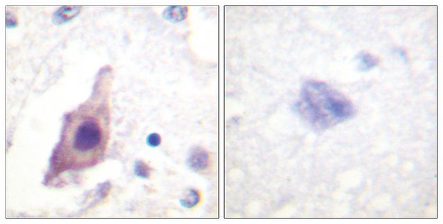 Anti-CDC25B antibody produced in rabbit