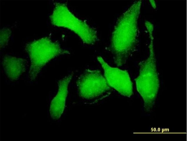 Anti-CDK5 antibody produced in mouse