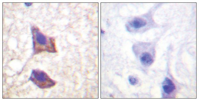 Anti-CD130 antibody produced in rabbit