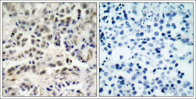 Anti-CDKN1B (Ab-10) antibody produced in rabbit