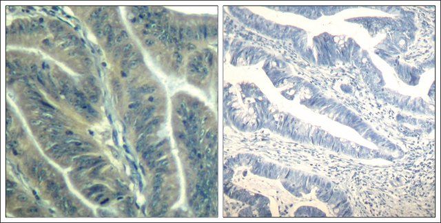 Anti-CDK6 (Ab-24) antibody produced in rabbit