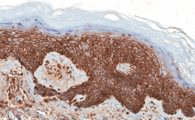 Anti-CD44v6 Antibody, exon v6, clone VFF-18