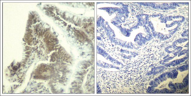 Anti-CDK6 (Ab-13) antibody produced in rabbit