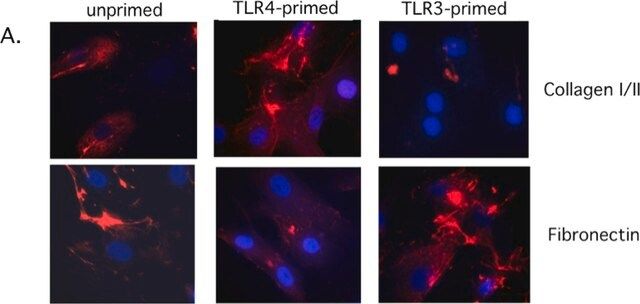 Anti-Collagen Type I Antibody, clone 5D8-G9