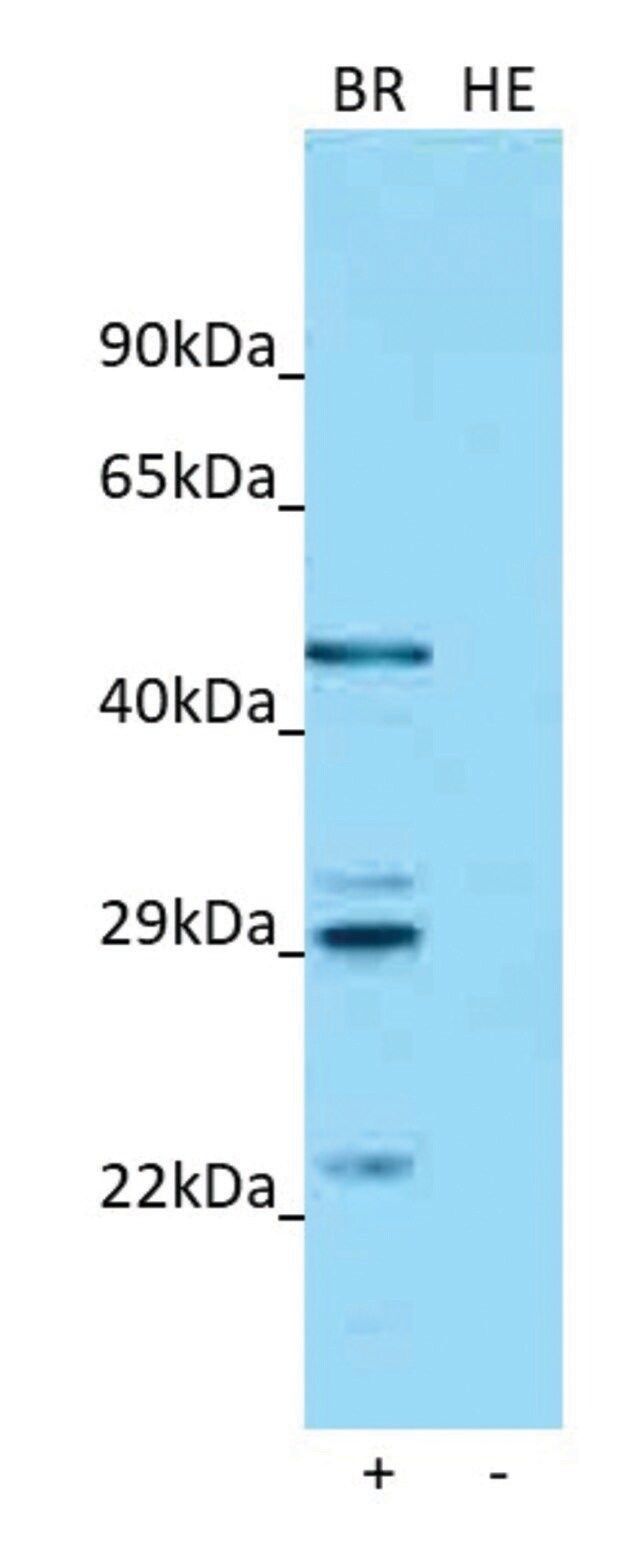 Anti-ASGR1 antibody produced in rabbit