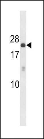 ANTI-ARHB (CENTER) antibody produced in rabbit